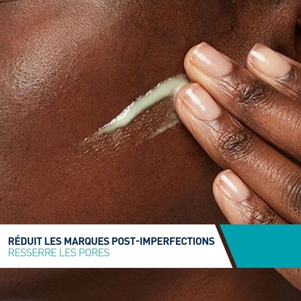 Sérum Rétinol Anti-Marques 30ml enrichi au Rétinol encapsulé et aux 3 céramides essentiels pour peaux à imperfections avec des marques post-acné (hype