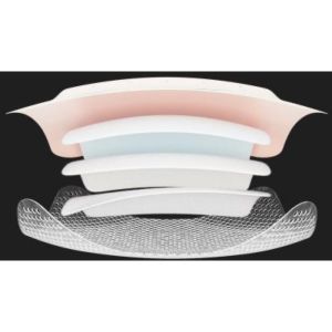 CONVAFOAM Pansement hydrocellulaire issu de la Technologie hydrofiber, adhésif siliconé, grand sacrum 24 cm x 21 cm (ref. 423256), bt 5