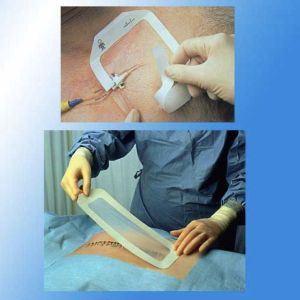 TEGADERM PANSEMENT ADHESIF STERILE 15*20 CM BT 10