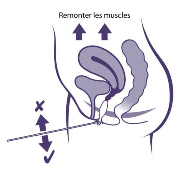 PERIFORM + Sonde d'électrostimulation vaginale et de Biofeedback EMG, unité